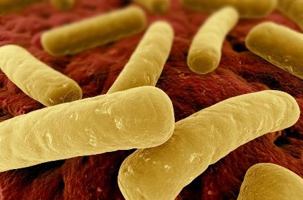 FMT, IBD és Clostridium difficile IBD és Clostridum infekció FMT eradikációs sikere: 79-85% IBD fellángolás