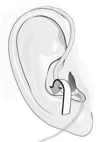 MINIRITE HASZNÁLATI ÚTMUTATÓ 15 B C Dóm nélkül soha ne tegye a fülébe a hangszórót. Ne erőltesse túl mélyre a hallójáratba a hangszórót.