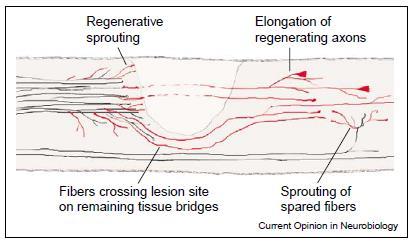 Regeneráció a CNS és a PNS axonokban problémák: proximális nyúlvány elongáció,