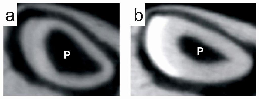 20. ábra: Vad-típusú (a) és PACAP-génhiányos (b) egerek metszőfogainak reprezentatív keresztmetszeti képe (mikro-ct felvétel). P: pulpa területe (sötét terület).