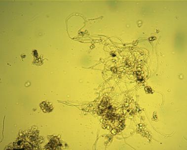 08 MICROTHRIX PARVICELLA Bejelölés néhány 1 igen