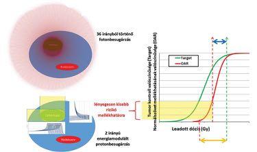 Lakosi F, Hadjiev J, Cselik Zs, Gulybán Á Protonterápia 317 2. ábra.