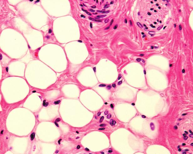 A kötő- és támasztószövetek 4. Az ínszövet erős fehérjerostjai egymással párhuzamosan, erős kötegekbe rendeződnek zsírsejtek A kötő- és támasztószövetek sejtjei nem kapcsolódnak szorosan egy máshoz.