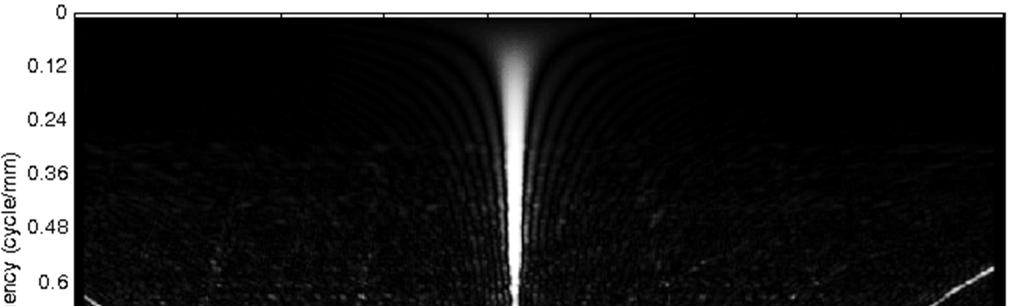 3D Röntgen tomográfia rekonstrukció Modulációs Átviteli