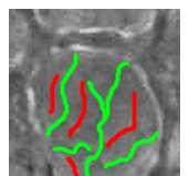 Alveoláris kapilláris perfúziós ráta SZEGEDI INTENZÍVES TALÁLKOZÓ 2010