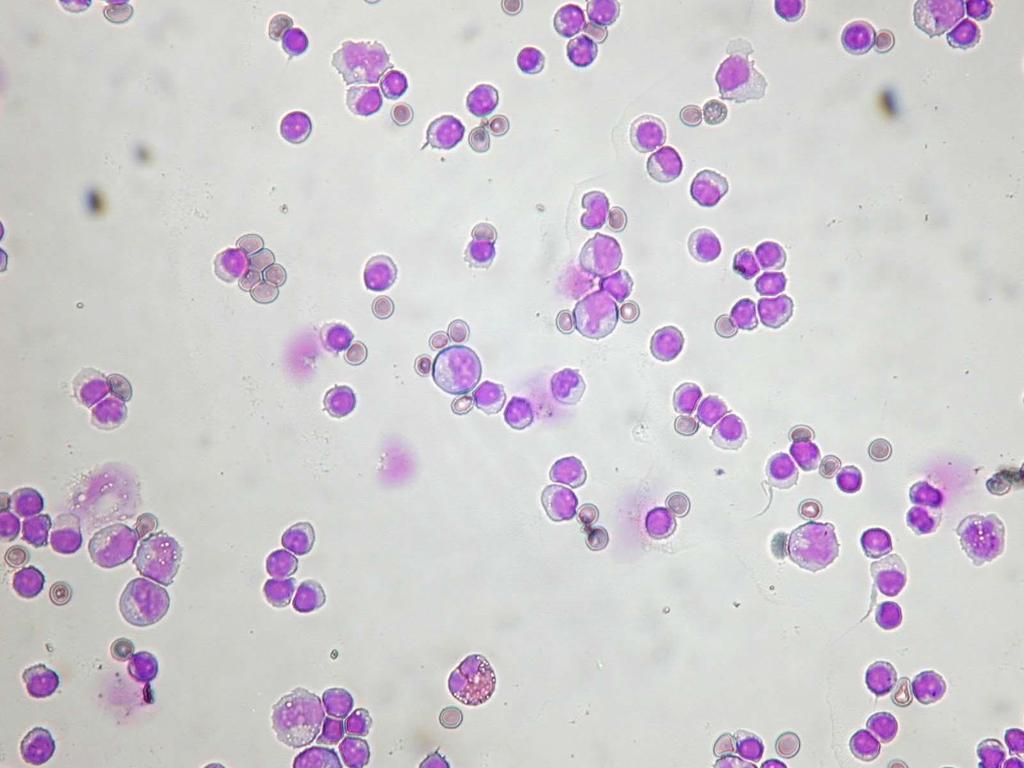 SEROSUS