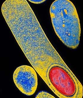 A Clostridium difficile spórák terjednek a levegőben DNS-ujjlenyomatok használatával kimutatható volt, hogy 10 betegből 7 C. difficile spórákat bocsátott ki a környezetébe. A levegőből tenyésztett C.