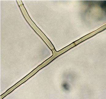 Tenyésztest: A Rhizoctonia solani, amely teleomorfja a Thanatephorus cucumeris Basidiomycota, ennek megfelelő