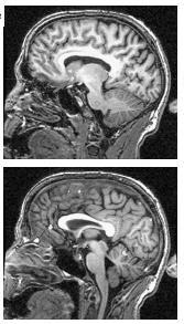 A befektetési döntések fiziológiai háttere Neuropénzügyek A nyereségnek vagy veszteségnek nem csak pénzügyi, pszichológiai,