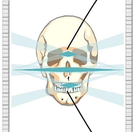 Cone-beam geometria szerinti vetületek FBP rekonstukciója - FDK