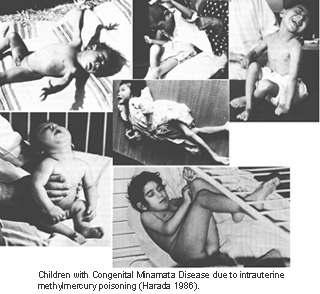 Nehézfémek Higany - lakossági szerveshigany-expozíció klasszikus példája: Minamata-betegség 1955.