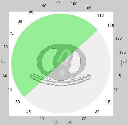 (a) sematikus ábrázolás (b) polar map 5.17. ábra. A becslés eredménye.