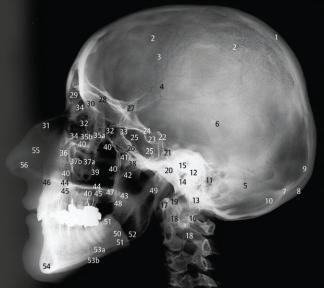 CBCT - Cone Beam Computed Tomography CBVT - Cone Beam