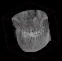 X-ray saves radiation ProMax 3D Technology