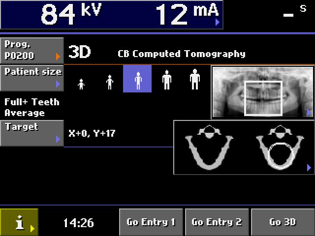 ProMax 3D patient size selection ProMax 3D cylinder location kv