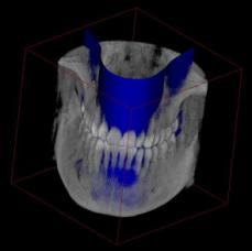 50 Molar Maxilla 40 x 50 Molar Mandible 40 x 50 kv/ma