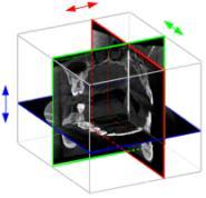 coronal, axial views real time adjustable viewing angles