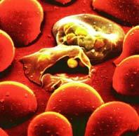 ovale maláriás megbetegedés hordozó: Anopheles sp.