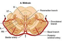 Vascularis elváltozás: az agyban : ISCHEMIÁS STROKE