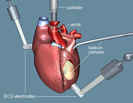 szintén ez a technika tette lehetővé Egy másik felületi potenciál az EKG amely izolált szív felületéről is