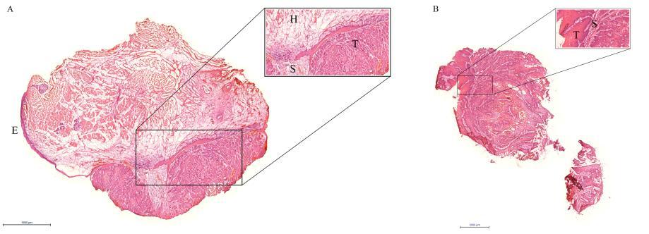 16. ábra: Standard haematoxylin-eosin festésű szövettani metszetek.