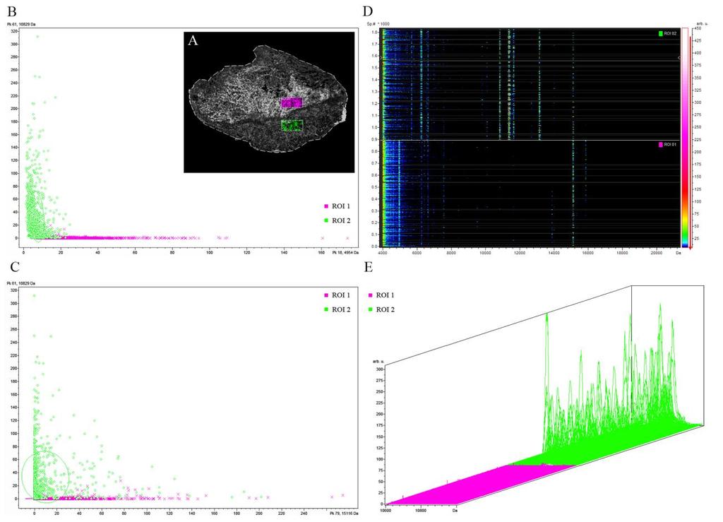 További bizonyítékként az S100A8 néhány reprezentatív triptikus peptidjét szekvenáltuk LID (Laser Induced) fragmentációval. A reprezentatív fragmentációs spektrum a függelékben látható (függelék 2.