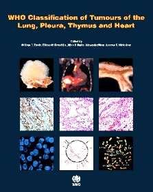 4) a completely different approach to lung adenocarcinomaas proposed by the 2011 Association for the Study of Lung Cancer/American Thoracic Society/European Respiratory Society classification 2015.