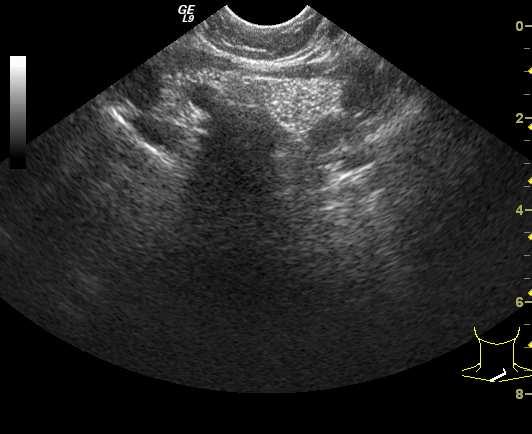 vérzés, cysta, hemangioma, lymphangioma