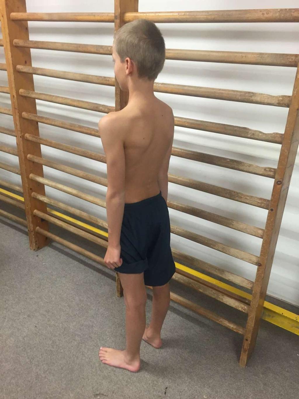 Murrell GA. Shoulder pain in elite swimmers: primarily due to swim-volume-induced supraspinatus tendinopathy. Br J Sports Med. 2010 Feb;44(2):105-13.
