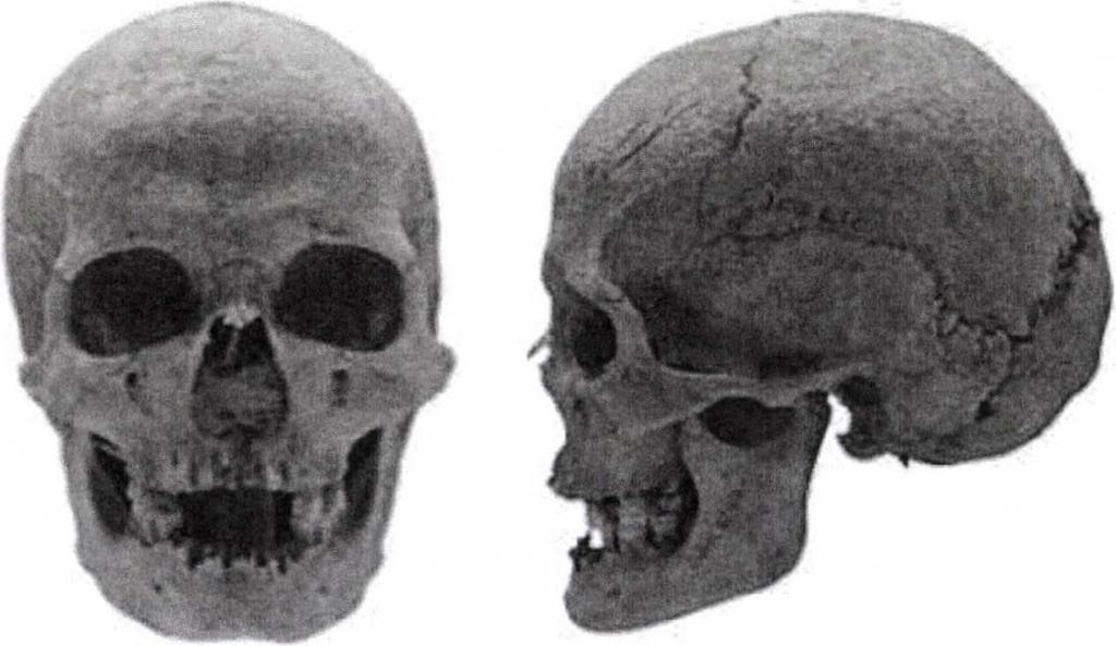 27. objektum, S-28. Leltári szám: 2010.6.16. 20-25 éves nő. A koponya, az állkapocs és a váz egyaránt töredékes és hiányos. Becsült testmagasság: 167,7 cm.