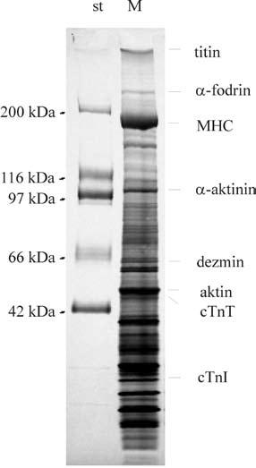 2. ábra. Humán balkamrai szívizomból készített szövethomogenizátum fehérjemintázata.