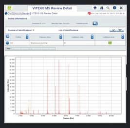 Ionization Time-of-Flight) technológián alapszik amely a kinyert spektrumot a VITEK MS adatbázisával elemzi ki.