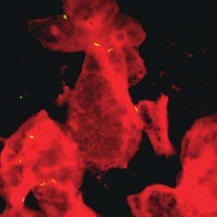 MYCOBACTERIUM DIAGNOSZTIKA Kódszám Megnevezés Kiszerelés Mycbactérium festése 411010 Previ Fluo TB 1kit Gyors, pontos és megbízható Mycobactérium kenet festõ A kit tartalma: R1 = Fixative (1 x 250