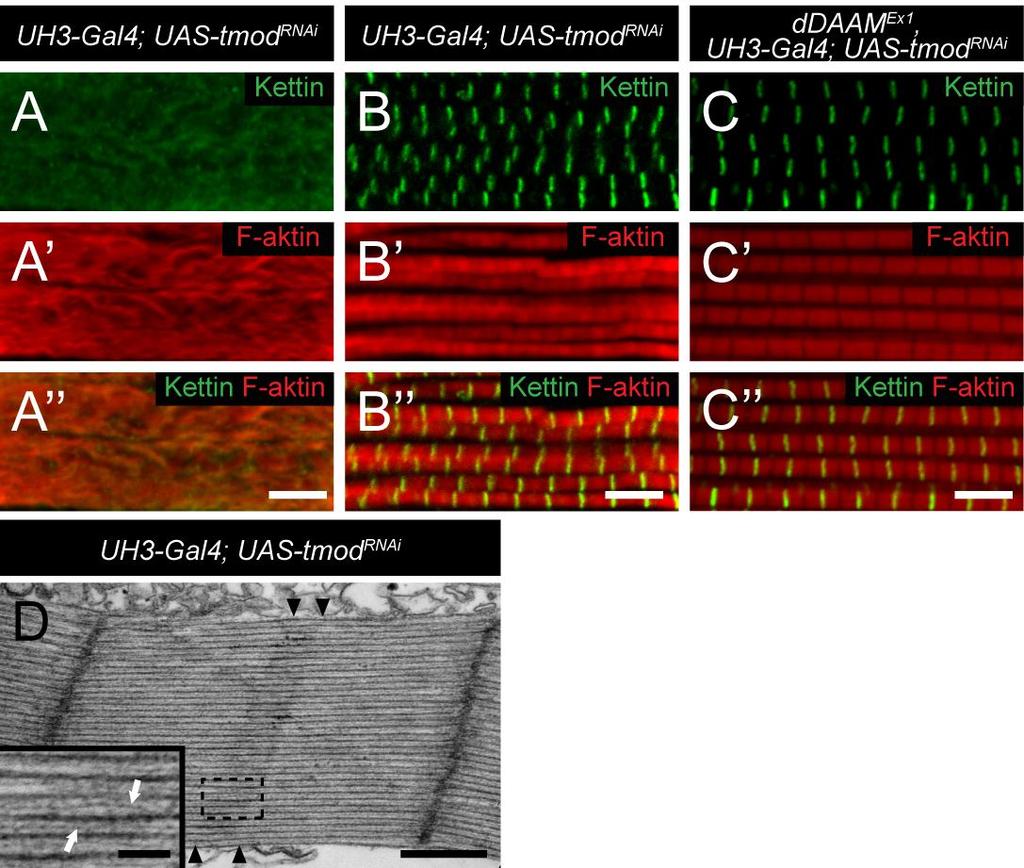 funkció gátlása meghosszabbodott szarkomereket eredményezett kardiomiocita sejttenyészetekben (Sussman és mtsai. 1998), illetve Drosophila primer izomsejt kultúrákban (Bai és mtsai. 2007).