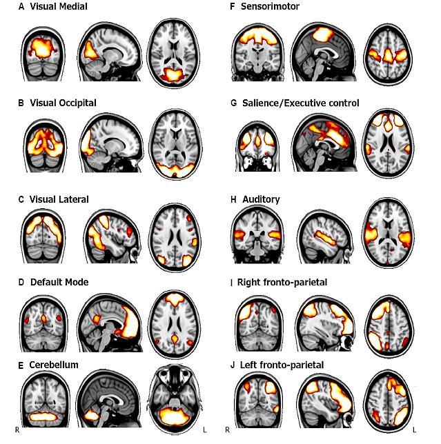 Reorganization of brain networks in aging: a review of functional connectivity studies Roser Sala-Llonch, David Bartrés-Faz and Carme Junqué* Frontiers in Psychology www.frontiersin.