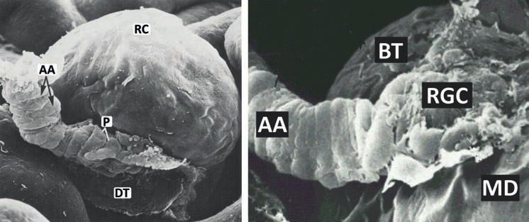 3. ábra: Az afferens arteriola (AA) és a juxtaglomeruláris szakasza, és a juxtaglomeruláris apparátus úgynevezett macerált készítménye Jól láthatók az arteriola proximális részét alkotó, gyűrű alakú