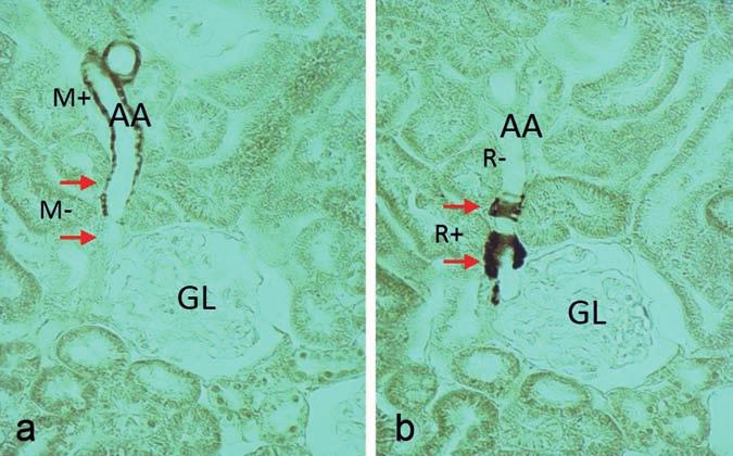 4 ábra: Az ábrán az afferens arteriola (AA) és a glomerulus (GL) látható (patkány vese, stimulált renin-angiotenzin rendszer) Ugyanazon nephron vékonymetszetein különböző immunfestés történt: a)