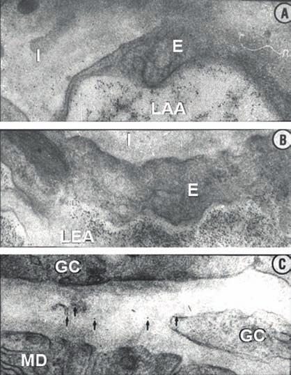 10. ábra: A ferritin szemcsék megoszlása az afferens, az efferens arteriolában és a JGA területén A) Az afferens arteriola interstíciumában jelentős mennyiségű ferritin mutatható ki.