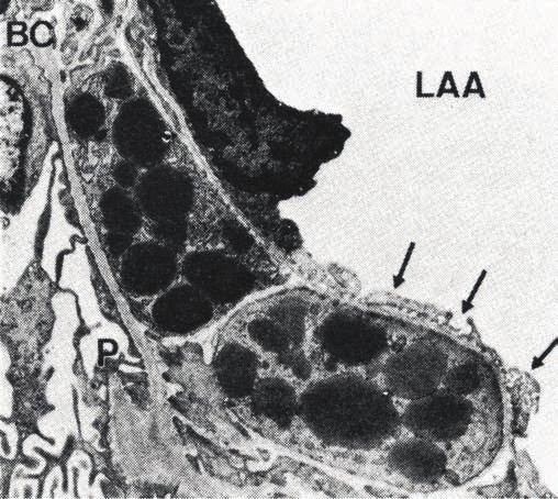 11. ábra: Renintartalmú granulált sejteket határoló struktúrák A granuláris sejteket az afferens arteriola (LAA) felől fenesztrált endothelium (nyilak), a glomerulus ürege felől a lábnyúlványokat és