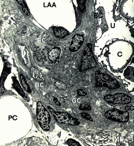 12. ábra: Juxtaglomularis apparátus extraglomerularis mezangiális területe Patkány extraglomeruláris mezangiális sejtjei között látható a vizeletűr betüremkedése, melynek ba sa lis lemezét