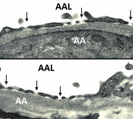 18. ábra: Patkány és mókuscickány afferens arteriola disztális végét borító fenesztrált endothelium keresztmetszeti elektronmikroszkópos képe Jól látszik, hogy a diaphragma nélküli fenesztrumok