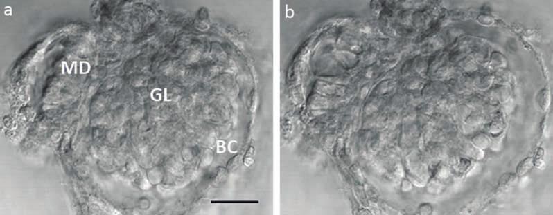 30. ábra: Perfundált izolált glomerulus a juxtaglomeruláris apparátussal Az intraglomeruláris nyomás emelése (jobb oldal) hatására nem csak a vizeletűr tágul ki, de a MD sejtek és a köztük lévő