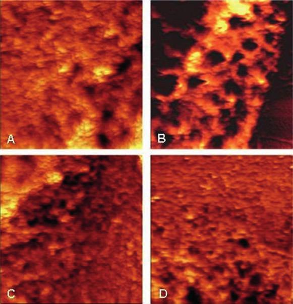 36. ábra: A VEGF és az Ang II hatása az endothel sejtréteg morfológiájára A transzmissziós elektronmikroszkóppal készült képeken látható, hogy mind az Ang II (B), mind a VEGF (C) kezelés hatására