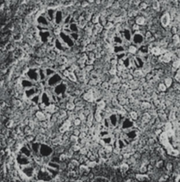 38. ábra: A endotheliális fenesztrációk nyílásában található diaphragma pásztázó elektronmikroszkópos képe Patkány veséből származó peritubuláris kapillárisról készült képen jól látható a PV-1