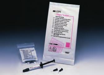 Professzionális profilaxis Clinpro Sealant (3M) A Clinpro Sealant egy fényrekötő, alacsony viszkozitású, fluorid-leadó, barázdazáró szer, egyedülálló színváltó tulajdonsággal.