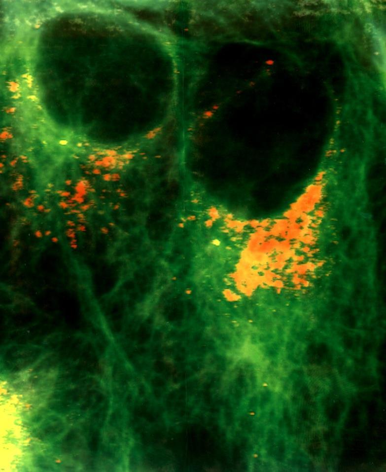 Dynamics of Cathepsin B