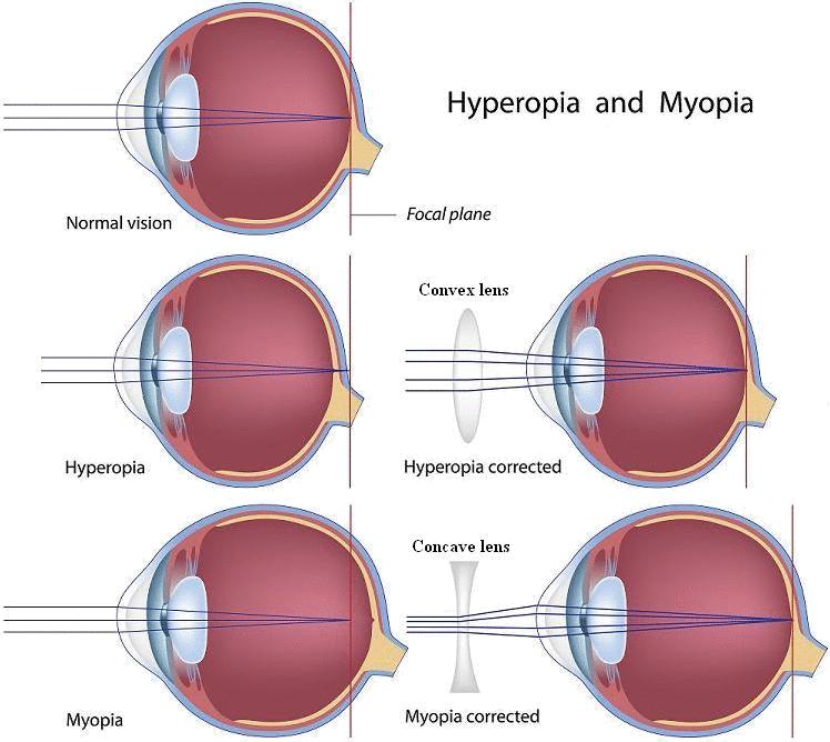A csapok a színlátásért és a világos adaptációért, a pálcikák a sötétadaptációért felelős sejtek. [2] 2.1.3. A szem optikai rendszere A látásérzet bonyolult folyamat végeredményeként jön létre.