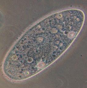 LÁTHATATLAN ÉLŐVILÁG AZ EUKARIÓTA EGYSEJTŰEK ORSZÁGA Az eukarióta sejtek sokkal nagyobbak és bonyolultabb felépítésűek a prokariótáknál.