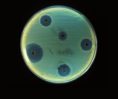 baktériumfertőzések fontos gyógyszere. A gombák növényekkel, állatokkal, emberekkel, sőt prokarióta sejtekkel is képesek tartós kapcsolatokat kialakítani.