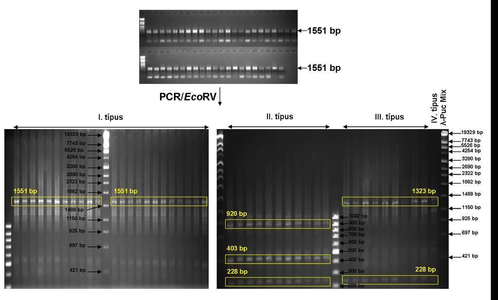 6. ábra: C. albicans izolátumok FZRV régiójának PCR-RFLP képe További mtnds RFLP típusok elkülönítésére különböző földrajzi helyekről származó, törzsgyűjteményes C.